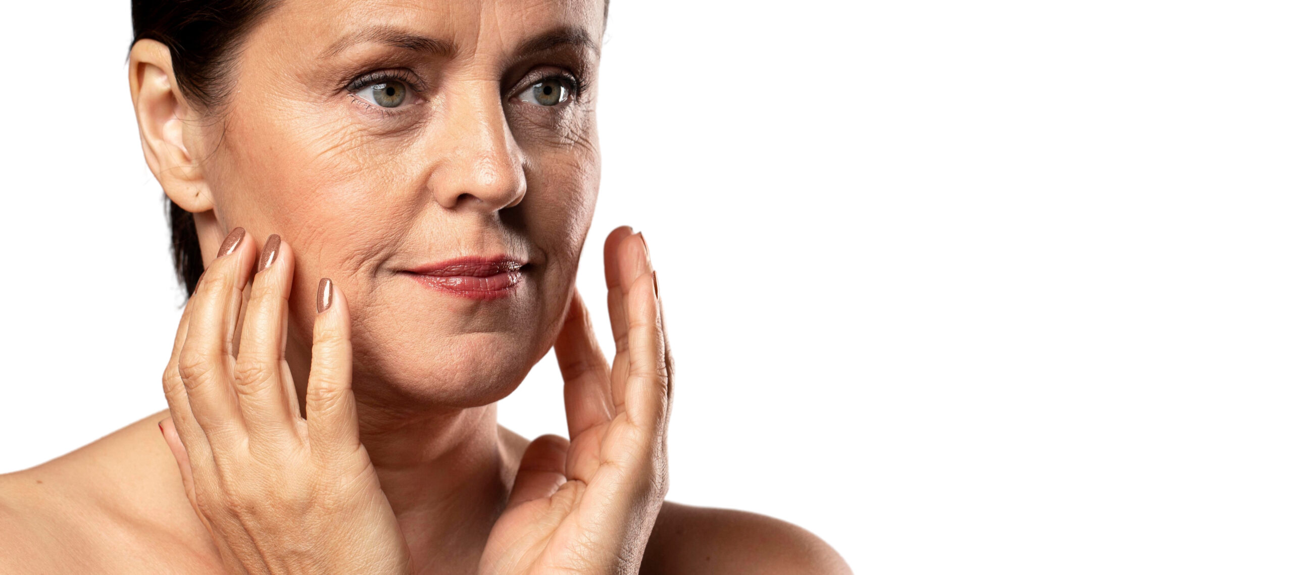 Flacidez facial